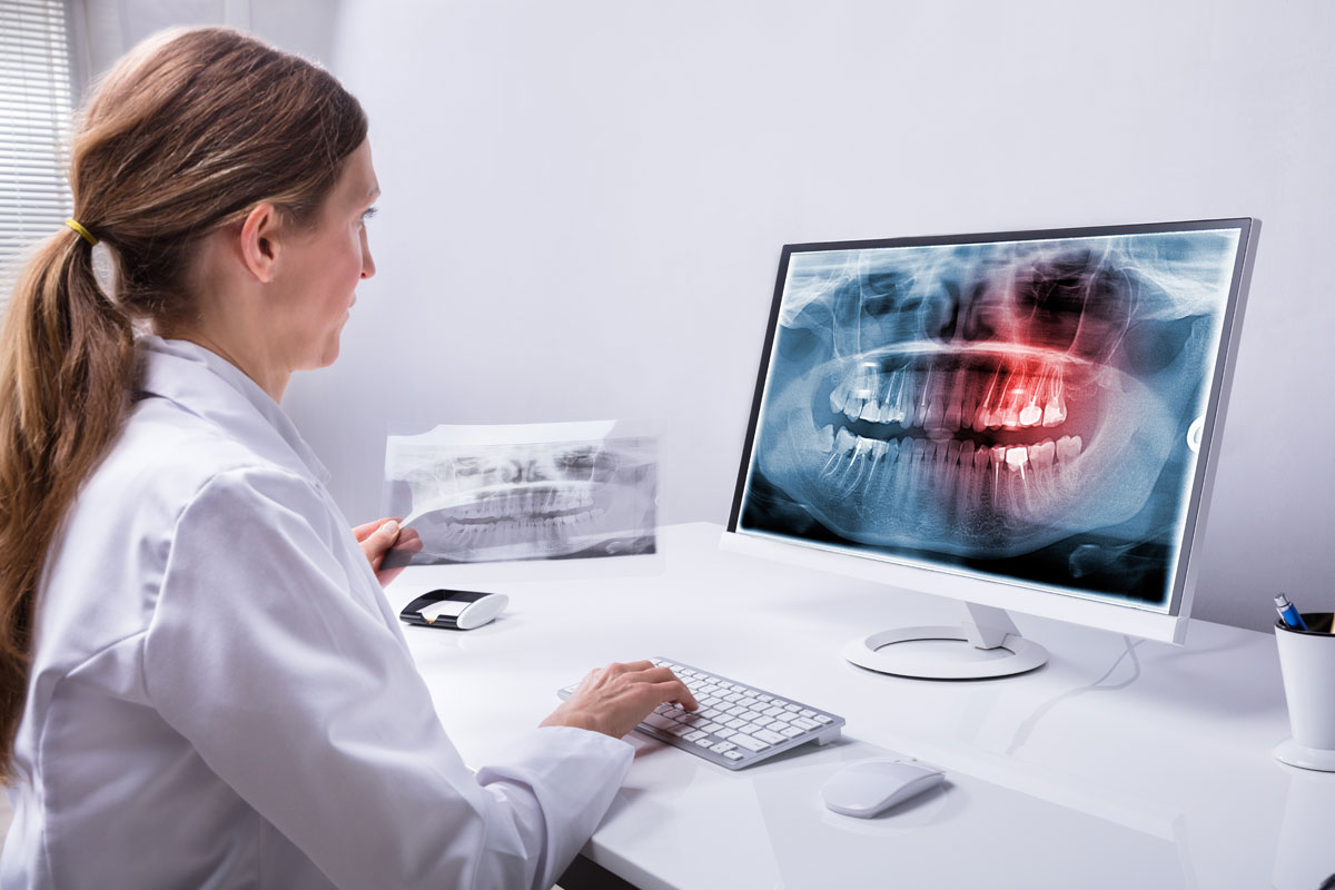 indagini radiografiche denti
